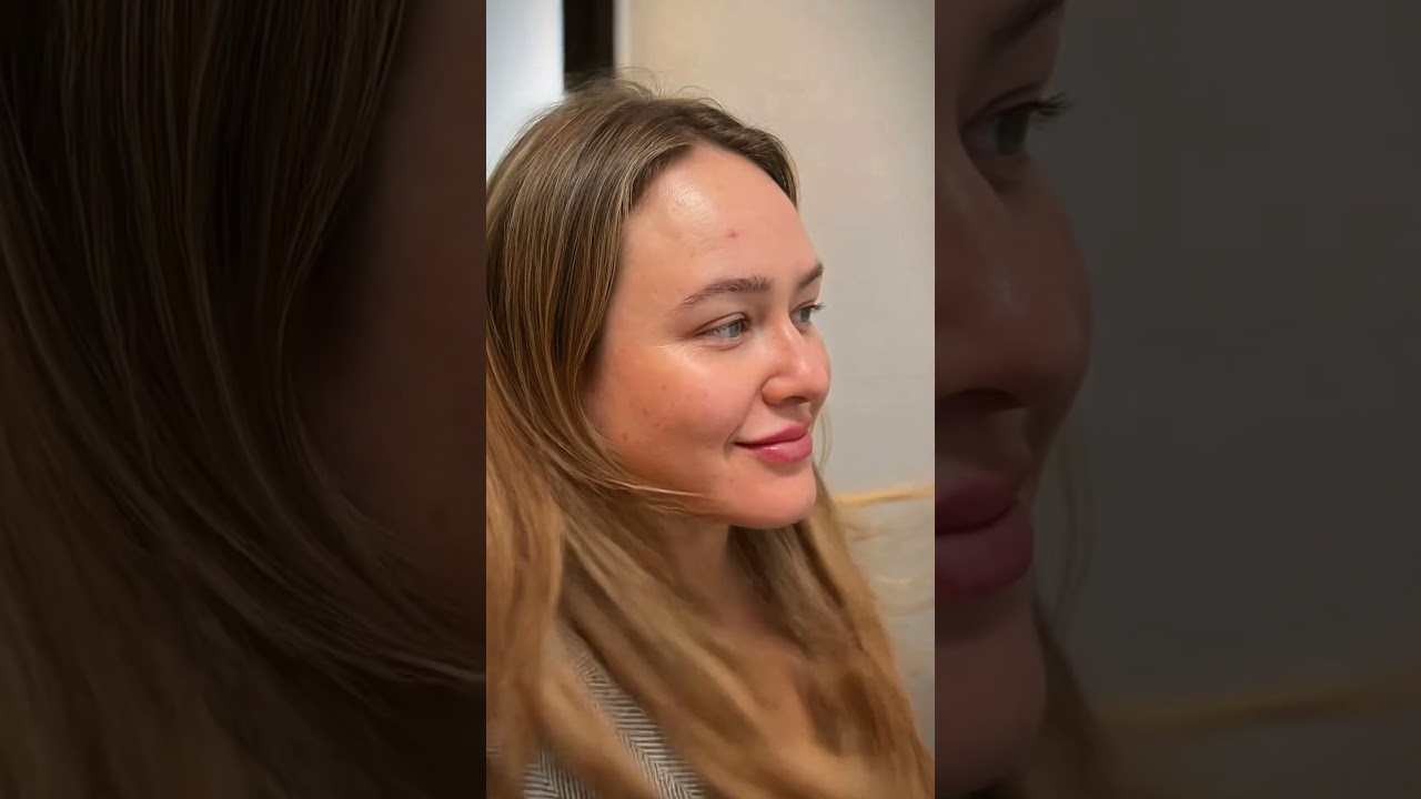 [PROJETO] 🦷 Dra. Ana Clara: Estética e Resultado Rápido   #estetica  #motiongraphics