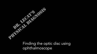 Eye 1:  Finding optic disc using opthalmoscope