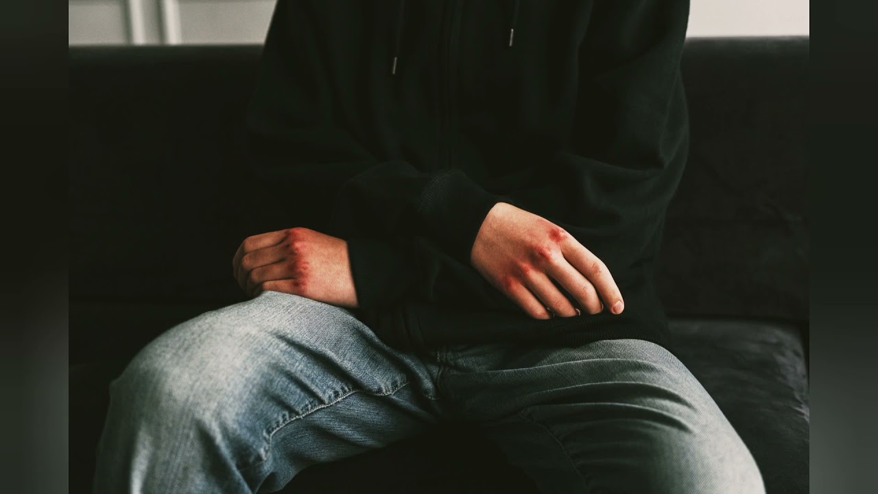 ASMR Roleplay - Curas las heridas de tu novio