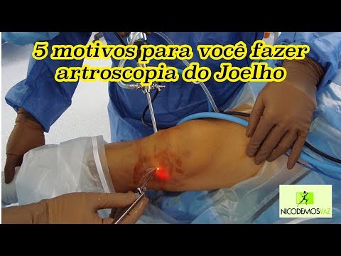 Vídeo: 5 Razões Para Considerar A Cirurgia De Substituição Do Joelho