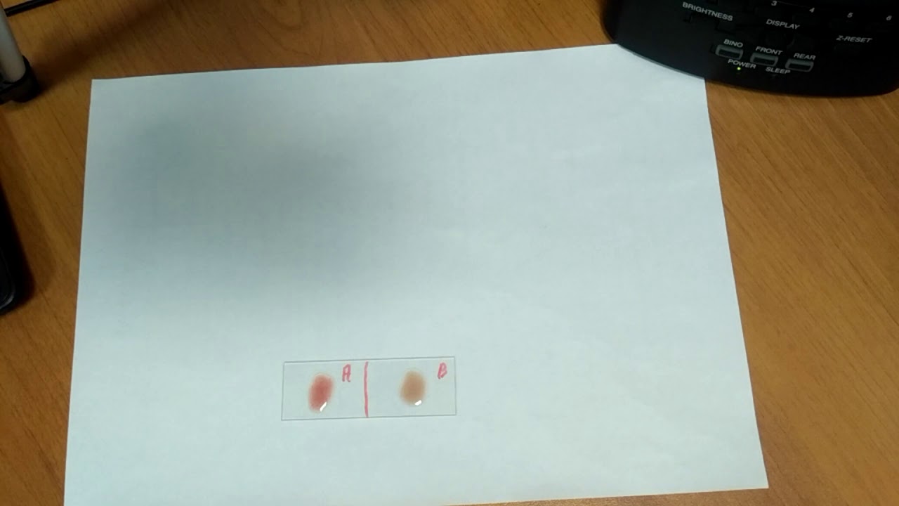 Определение групп Крови по системе Ландштейнера AB0