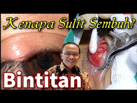 Video: Gambar Pertama Opera Sabun Dokter