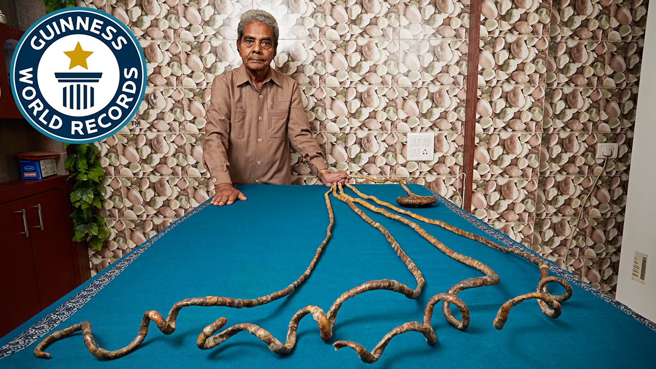 Pune man with longest fingernails to cut them after 66 years, flown to US  for 'nail clipping ceremony' | Trending & Viral News