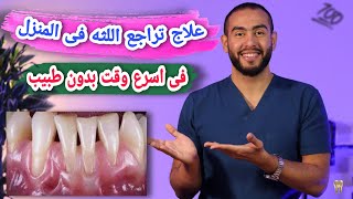 علاج تراجع اللثه فى المنزل بدون طبيب فى اسرع وقت ??| 7طرق طبيعية لعلاج تراجع اللثه ??