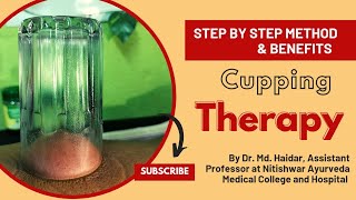 Cupping therapy || Cupping therapy benefits || Procedure|| Cupping therapy benefits in Hindi