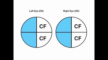 RS Visual Fields Part 1 - Performing The Tests