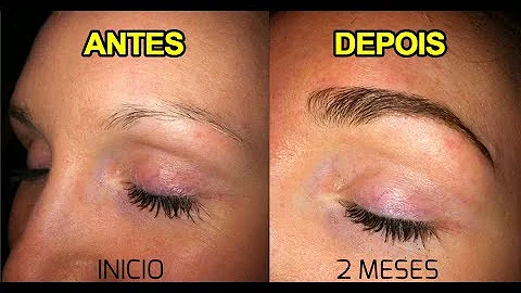 Porque as sobrancelhas ficam ralas?