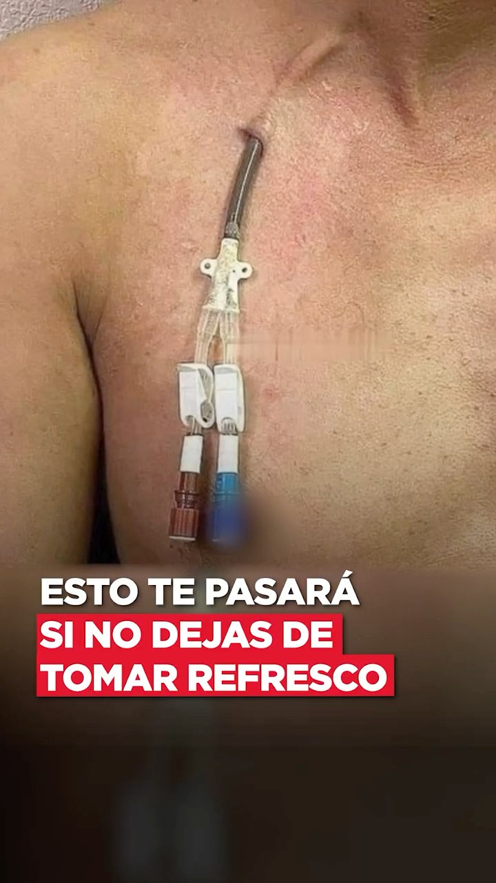 Esto le pasará a tu cuerpo si no dejas de tomar refresco @PaoCastilloOf