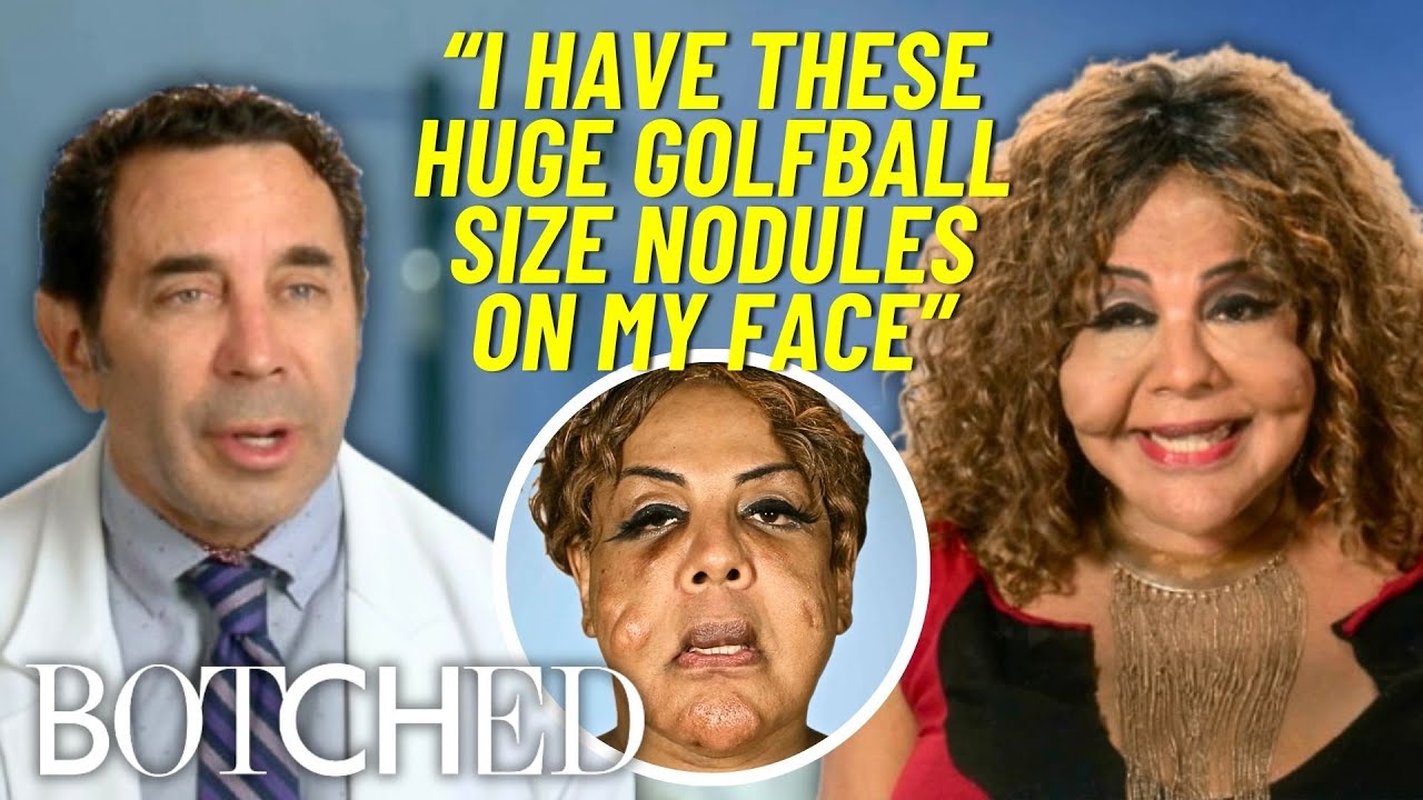 Rajee WAKES UP Mid-Surgery While Removing Black Market Cement Fillers | Botched | E!