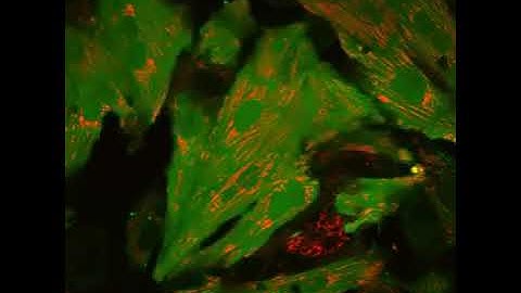 Calcium Imaging