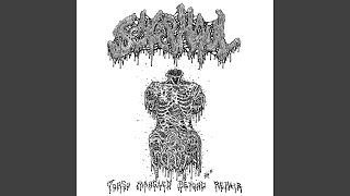 BRAIN DRAIN