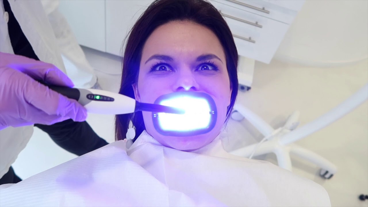 Izbjelila sam zube | Ženski Svijet