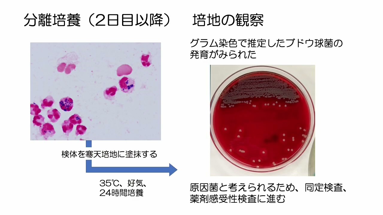 特売ンストア グラム染色診療ドリル・微生物プラチナアトラス・感染症