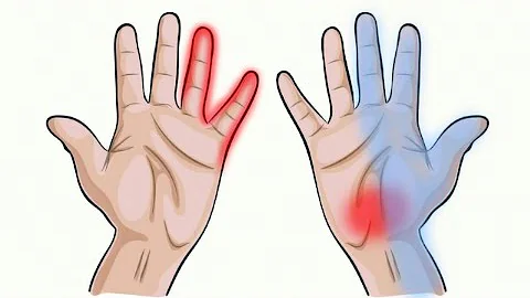 7 Things Your Hands Can Tell About Your Health