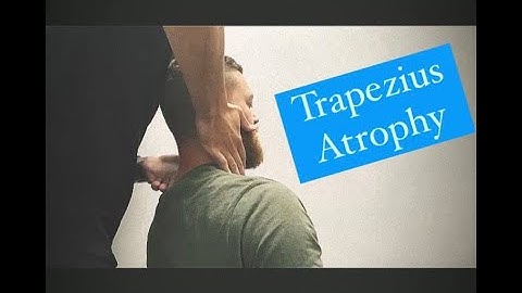 6 months of NECK PAIN and Trap ATROPHY, *GONSTEAD ADJUSTMENT*