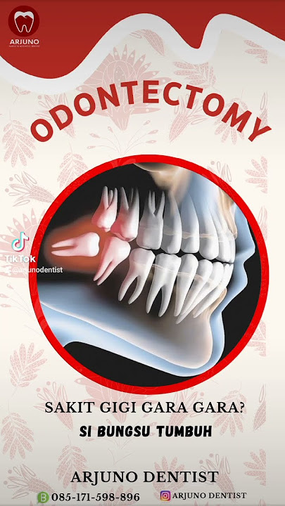 Hanya gara gara si bungsu tumbuh kamu tidak nafsu makan😱