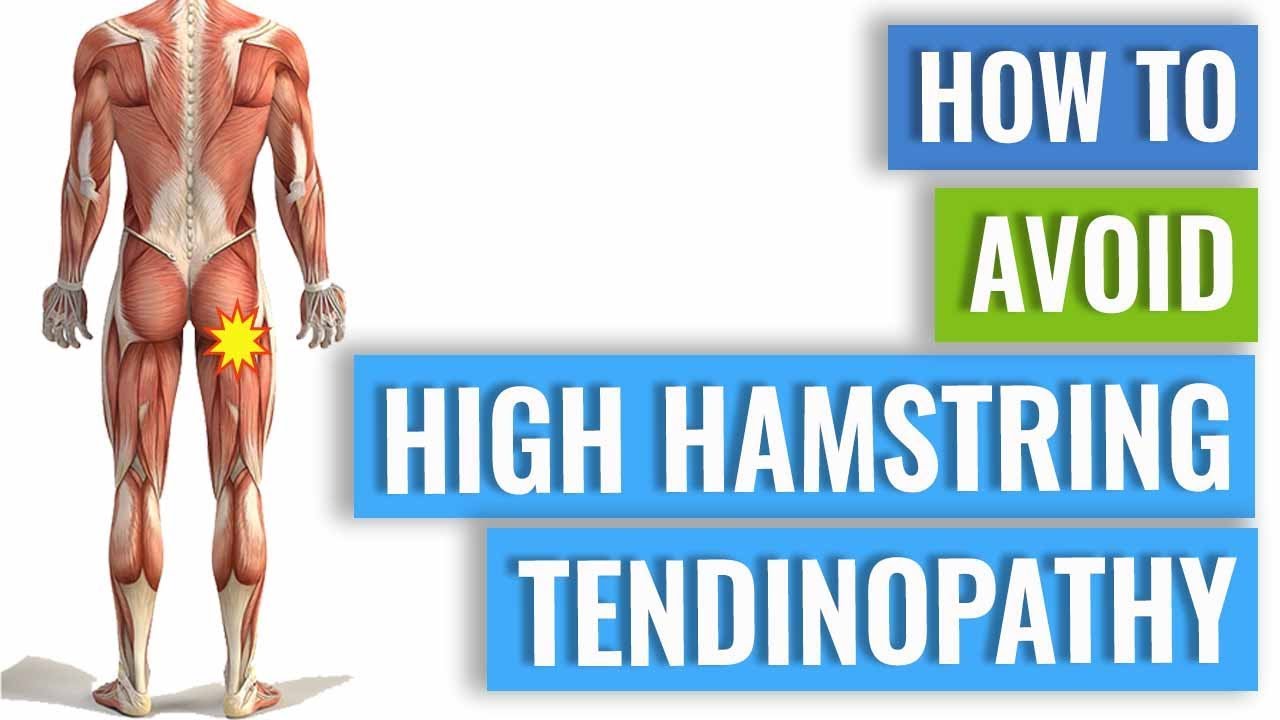 How to Avoid Getting High Hamstring Tendinopathy when Running - YouTube