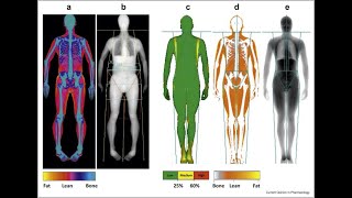 Dual Energy X Ray Absorptiometry Dxa Or Dexa Measuring Bone Mineral Density Bmd
