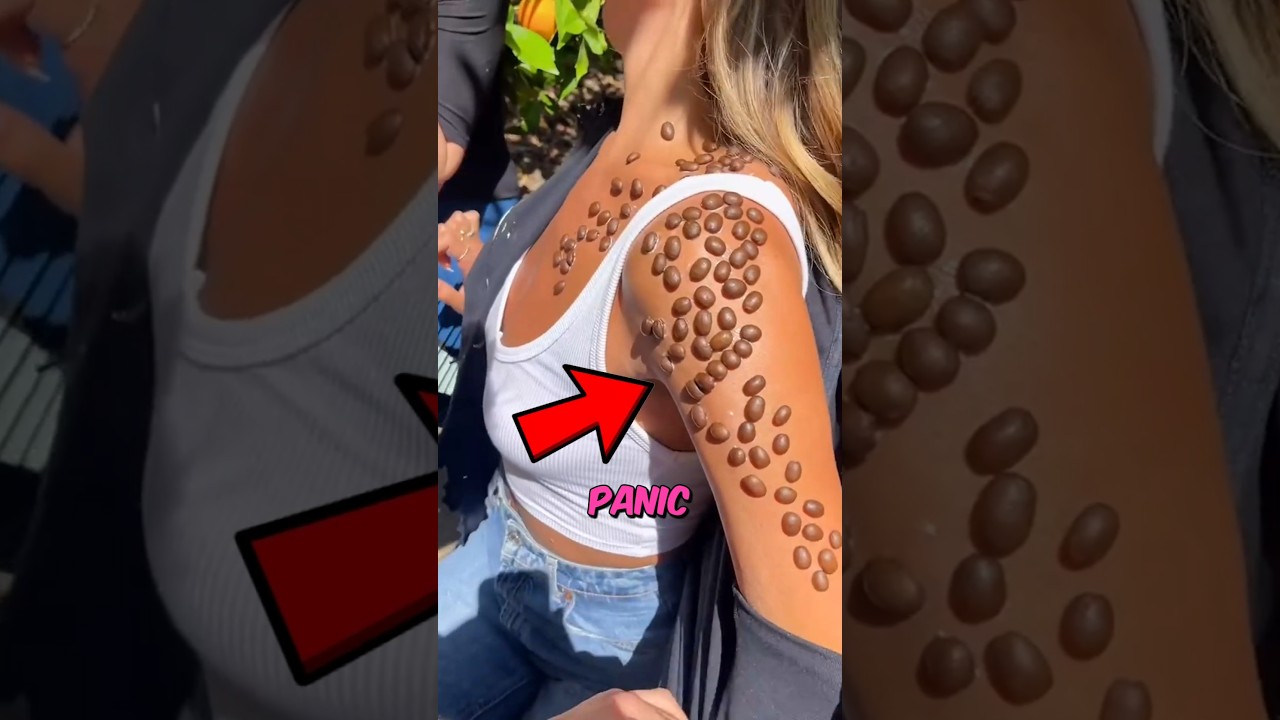 Tick Infestation 😨