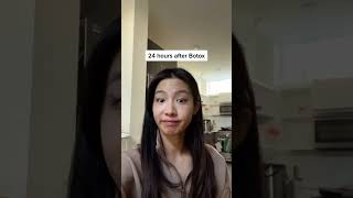 BEFORE vs. AFTER ✨ baby botox ✨ #shorts