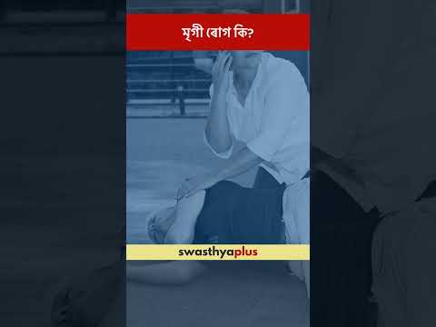 মৃগী ৰোগ কি? | What are Seizures? | Epilepsy | Dr Suvan Kanti Chowdhury