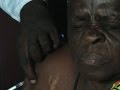 UN Bungles Africa’s Yellow Fever Outbreak