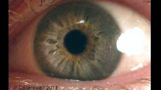 Eye Works 1: Focusing: Cornea, Iris and Lens