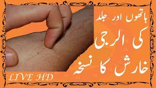 Elergy Problem Solution - Skin Problem Hand Elergy Also Full Body Elergy Use Home Made Remedy