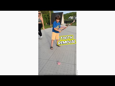 How Canadian kids remove teeth