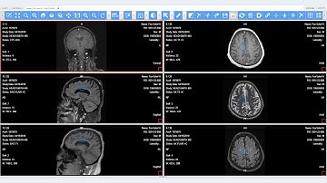 3D Cursor - LEADTOOLS Medical Web Viewer