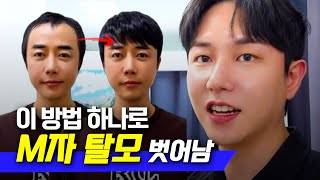 이것 몰라서 계속 앞머리 탈모였어요