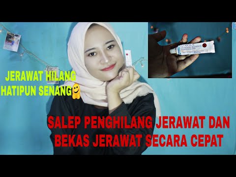 Video: Apakah betametason valerat membantu jerawat?