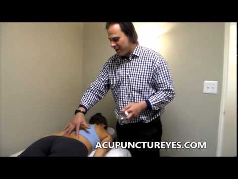 Acupuncture/Cupping For Relief and Anxiety      Integrative Acupuncture Ridgewood NJ