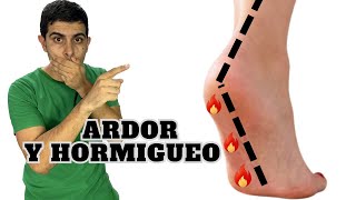 Neuropatía : Ardor y hormigueo en los pies