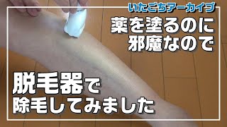 脱毛器ソイエ(Soie)を使ってみた