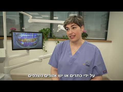 ד"ר מירה כץ- השתלת שיניים ושיקום פה