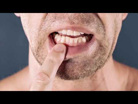 Video: Psikosomatika E Sëmundjeve Të Dhëmbëve Dhe Mishrave Të Dhëmbëve, Nga Këndvështrimi I Psikanalizës