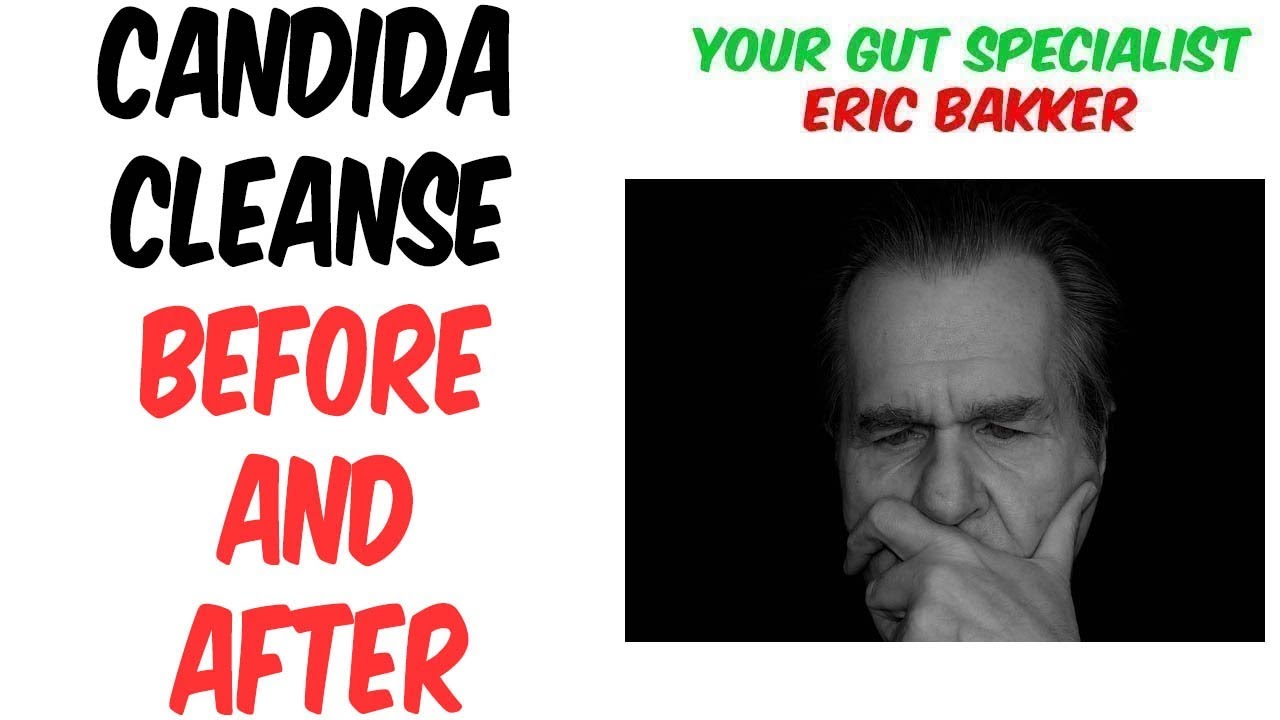 Candida Cleanse Before and After? What Results Can I Expect? YouTube