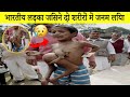 भारतीय लड़का दीपक जो दो शरीर के अंगों के साथ पैदा हुआ | Indian Boy Deepak Born With Two Body Part |