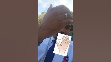 Boost your immune system with acupuncture #thehealingpoint #acupuncture