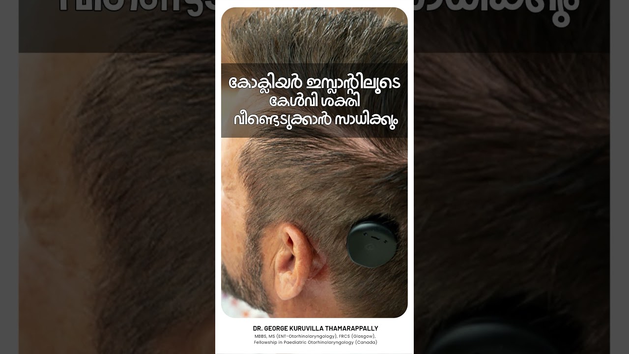 ശ്രവണ വൈകല്യം പരിഹരിക്കാൻ കോക്ലിയർ ഇമ്പ്ലാന്റിലൂടെ സാധിക്കുന്നു. കൂടുതൽ അറിയാനായി ഉടനെ ബന്ധപ്പെടുക