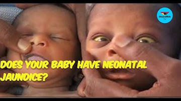 What every parent must know about Neonatal Jaundice | Health Focus