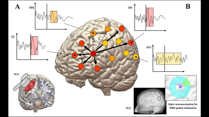 Berenson-Allen Center for Noninvasive Brain Stimul...