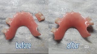 How to fix a broken denture