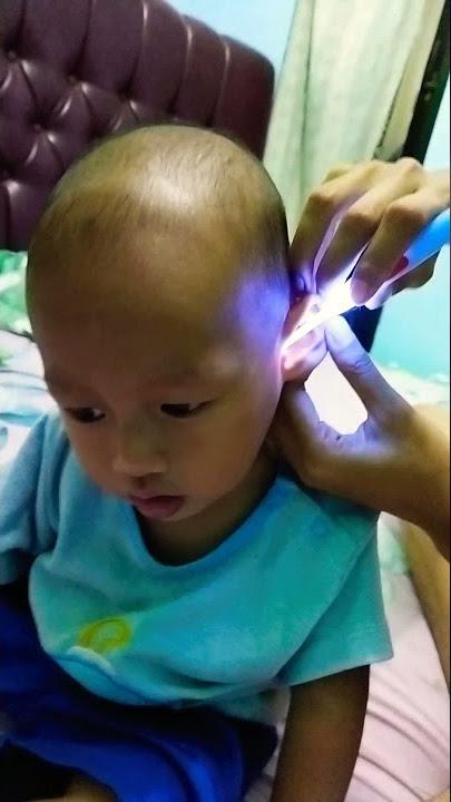 membersihkan telinga anak