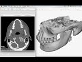 CT Scan DICOM Files to 3D [HD]