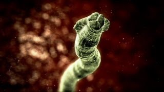 Deadly Roundworm  Monsters Inside Me Ep6