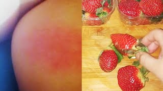 هل سمعتم عن حساسية الفراوله 🍓🍓🍓وقد تسبب الوفاة 😧