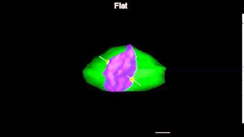 Cell shape impacts on the positioning of the mitotic spindle with respect to the substratum