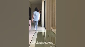 Walking 6 months post femur fracture surgery